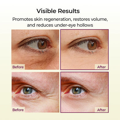 Cemenrete Calcium Multi Balm Wrinkles Face Eye Balm